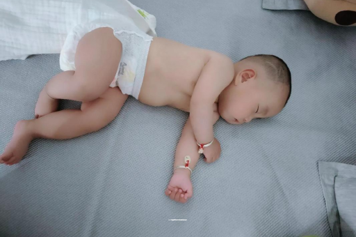 当阳宝宝头上长痱子